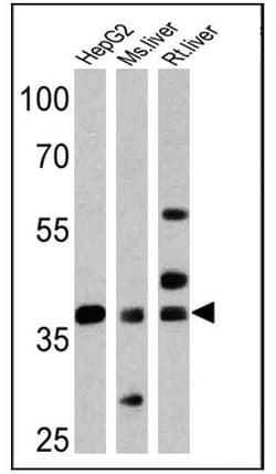 Invitrogen FOXA3 Polyclonal Antibody 100 &mu;g; Unconjugated:Antibodies,