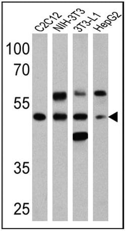 Invitrogen Phospho-PPAR alpha (Ser12) Polyclonal Antibody 100 &mu;g; Unconjugated:Antibodies,