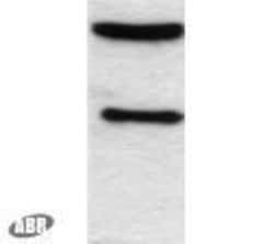 C/EBP alpha Polyclonal Antibody:Antibodies, Polyclonal
