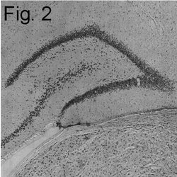 Invitrogen SRC1 Polyclonal Antibody 100 &mu;g; Unconjugated:Antibodies,