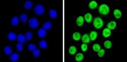 Invitrogen™ NCoR2 Polyclonal Antibody