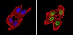 Invitrogen NCoR2 Polyclonal Antibody 100 &mu;g; Unconjugated:Antibodies,