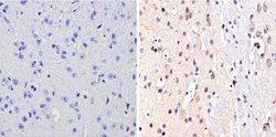 Invitrogen NCoR2 Polyclonal Antibody 100 &mu;g; Unconjugated:Antibodies,