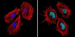 Invitrogen CBP Polyclonal Antibody 100 &mu;g; Unconjugated:Antibodies,