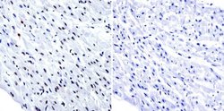 Invitrogen HDAC1 Polyclonal Antibody 100 &mu;g; Unconjugated:Antibodies,