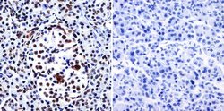 Invitrogen HDAC1 Polyclonal Antibody 100 &mu;g; Unconjugated:Antibodies,