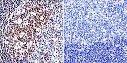 Invitrogen HDAC1 Polyclonal Antibody 100 &mu;g; Unconjugated:Antibodies,