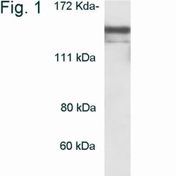 Invitrogen HDAC4 Polyclonal Antibody 100 &mu;g; Unconjugated:Antibodies,