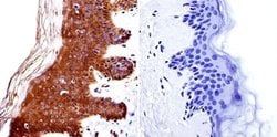 Invitrogen™ HDAC4 Polyclonal Antibody