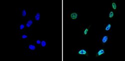Invitrogen SIN3A Polyclonal Antibody 100 &mu;g; Unconjugated:Antibodies,