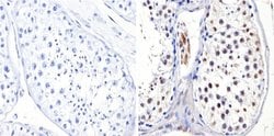 Invitrogen DNMT3B Polyclonal Antibody 100 &mu;g; Unconjugated:Antibodies,