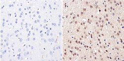 Invitrogen DNMT3B Polyclonal Antibody 100 &mu;g; Unconjugated:Antibodies,