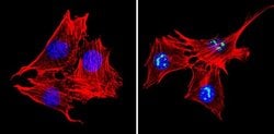 Invitrogen MECP2 Polyclonal Antibody 50 &mu;g; Unconjugated:Antibodies,