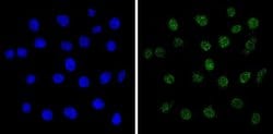 Invitrogen MECP2 Polyclonal Antibody 50 &mu;g; Unconjugated:Antibodies,