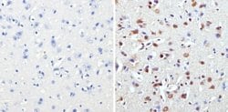 Invitrogen MECP2 Polyclonal Antibody 50 &mu;g; Unconjugated:Antibodies,
