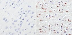Invitrogen MECP2 Polyclonal Antibody 50 &mu;g; Unconjugated:Antibodies,