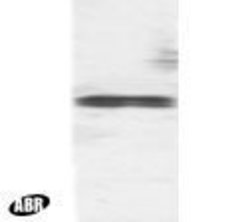TFEB Polyclonal Antibody, Invitrogen 100 &mu;g | Buy Online | Thermo Scientific | Fisher Scientific