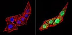 Invitrogen™ Calsequestrin Polyclonal Antibody