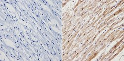 Invitrogen Calsequestrin Polyclonal Antibody 100 &mu;L; Unconjugated:Antibodies,
