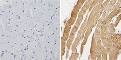 Invitrogen Calsequestrin Polyclonal Antibody 100 &mu;L; Unconjugated:Antibodies,