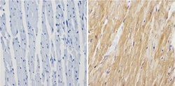 Invitrogen Calsequestrin Polyclonal Antibody 100 &mu;L; Unconjugated:Antibodies,