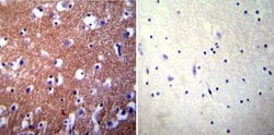 Invitrogen PMCA3 ATPase Polyclonal Antibody 100 &mu;g; Unconjugated:Antibodies,