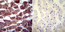 Invitrogen PMCA3 ATPase Polyclonal Antibody 100 &mu;g; Unconjugated:Antibodies,