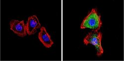 Invitrogen VDAC Polyclonal Antibody 100 &mu;g; Unconjugated:Antibodies,