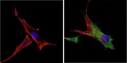 Invitrogen VDAC Polyclonal Antibody 100 &mu;g; Unconjugated:Antibodies,