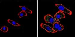 Invitrogen VDAC Polyclonal Antibody 100 &mu;g; Unconjugated:Antibodies,