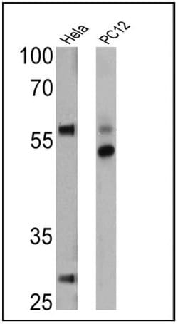 Invitrogen TRAIL-R2 (DR5) Polyclonal Antibody 100 &mu;g; Unconjugated:Antibodies,
