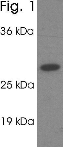 Invitrogen PSME1 Polyclonal Antibody 100 &mu;g; Unconjugated:Antibodies,