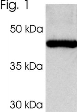 Invitrogen PSMC3 Polyclonal Antibody 100 &mu;L; Unconjugated:Antibodies,