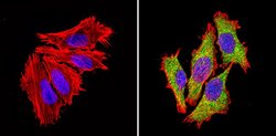Invitrogen PSMD3 Polyclonal Antibody 100 &mu;g; Unconjugated:Antibodies,