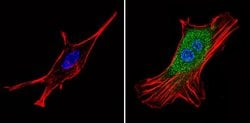 Invitrogen PSMD3 Polyclonal Antibody 100 &mu;g; Unconjugated:Antibodies,