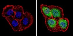 Invitrogen PSMB5 Polyclonal Antibody 100 &mu;g; Unconjugated:Antibodies,