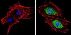 Invitrogen PSMB5 Polyclonal Antibody 100 &mu;g; Unconjugated:Antibodies,