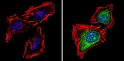 Invitrogen PSMB5 Polyclonal Antibody 100 &mu;g; Unconjugated:Antibodies,