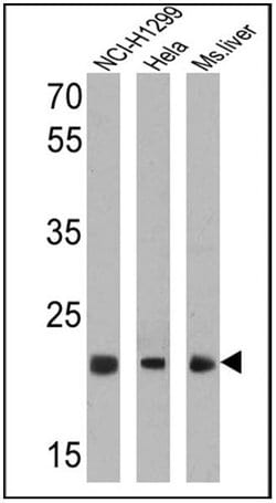 Invitrogen PSMB5 Polyclonal Antibody 100 &mu;g; Unconjugated:Antibodies,