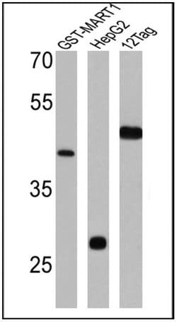 Invitrogen GST Tag Polyclonal Antibody 100 &mu;g; Unconjugated:Antibodies,