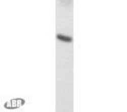 Invitrogen RFP Polyclonal Antibody 100 &mu;g; Unconjugated:Antibodies,