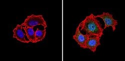 Invitrogen PKR Polyclonal Antibody 100 &mu;g; Unconjugated:Antibodies,