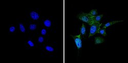 Invitrogen PKR Polyclonal Antibody 100 &mu;g; Unconjugated:Antibodies,