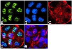 Invitrogen Phospho-IRS1 (Ser307) Polyclonal Antibody 100 &mu;g; Unconjugated:Antibodies,