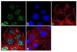 Invitrogen™ Androgen Receptor Polyclonal Antibody