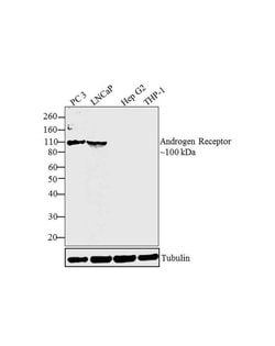 Invitrogen Androgen Receptor Polyclonal Antibody 100 &mu;g; Unconjugated:Antibodies,