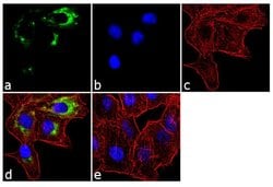 Invitrogen APH1 Polyclonal Antibody 100 &mu;g; Unconjugated:Antibodies,