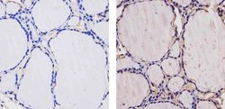 Invitrogen THRA Polyclonal Antibody 100 &mu;L | Buy Online | Invitrogen&trade; | Fisher Scientific