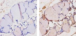 Invitrogen THRA Polyclonal Antibody 100 &mu;L | Buy Online | Invitrogen&trade; | Fisher Scientific