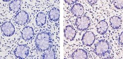 Invitrogen THRB Polyclonal Antibody 100 &mu;L; Unconjugated:Antibodies,